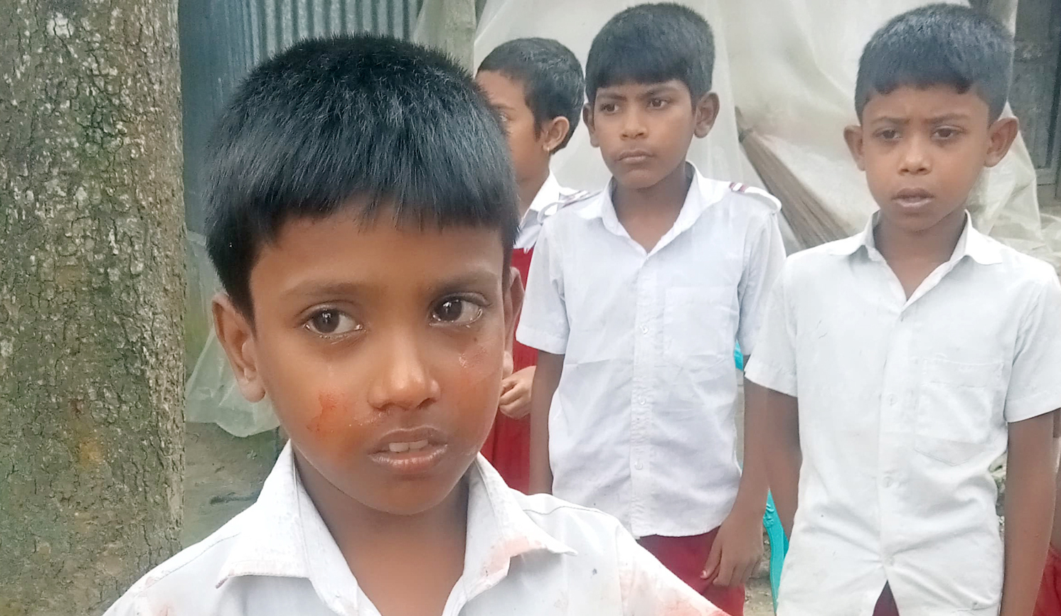 তুচ্ছ ঘটনায় শিশু শিক্ষার্থীর নাক ফাটালেন সহকারি শিক্ষক!
