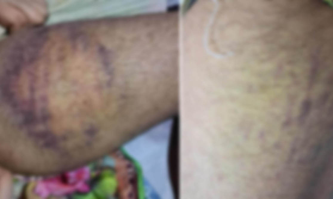রাজশাহীর মাদ্রাসায় শিশু নির্যাতনের অভিযোগ, থানায় এজাহার