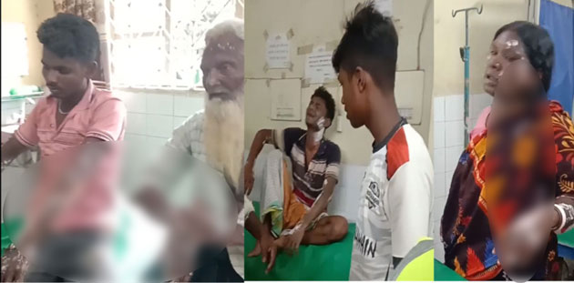 গোদাগাড়ীতে গ্যাস বেলুন বিস্ফোরণে ৬ জন দগ্ধ