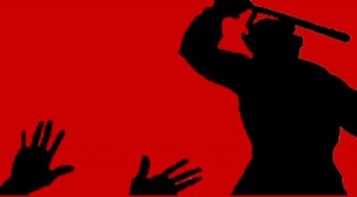 চাঁপাইনবাবগঞ্জে গণপিটুনিতে ডাকাত নিহত
