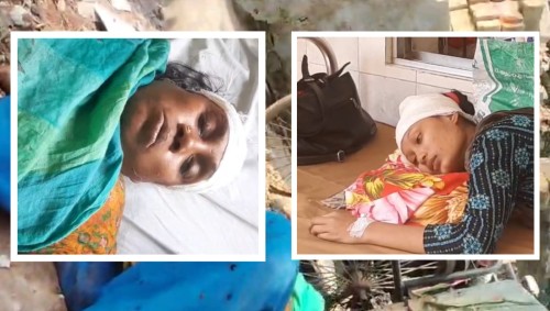 রাজশাহীতে প্রতিপক্ষের হামলায় মা-মেয়ে জখম, থানায় মামলা