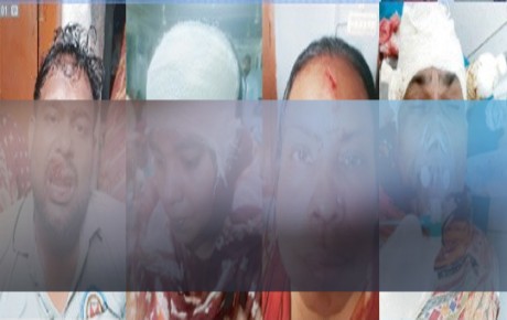 নগরীতে প্রতিপক্ষের হামলায় একই পরিবারের ৫ সদস্য আহত